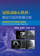 冠状动脉心肌桥：基础与临床影像诊断