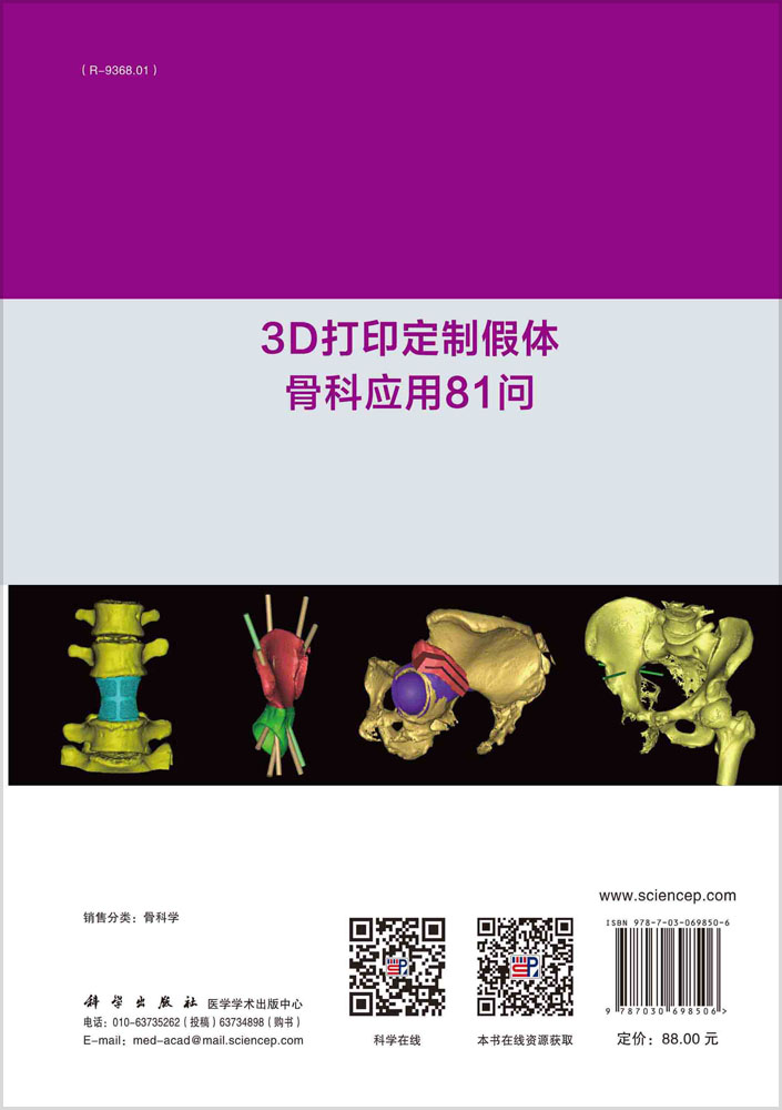 3D打印定制假体骨科应用81问