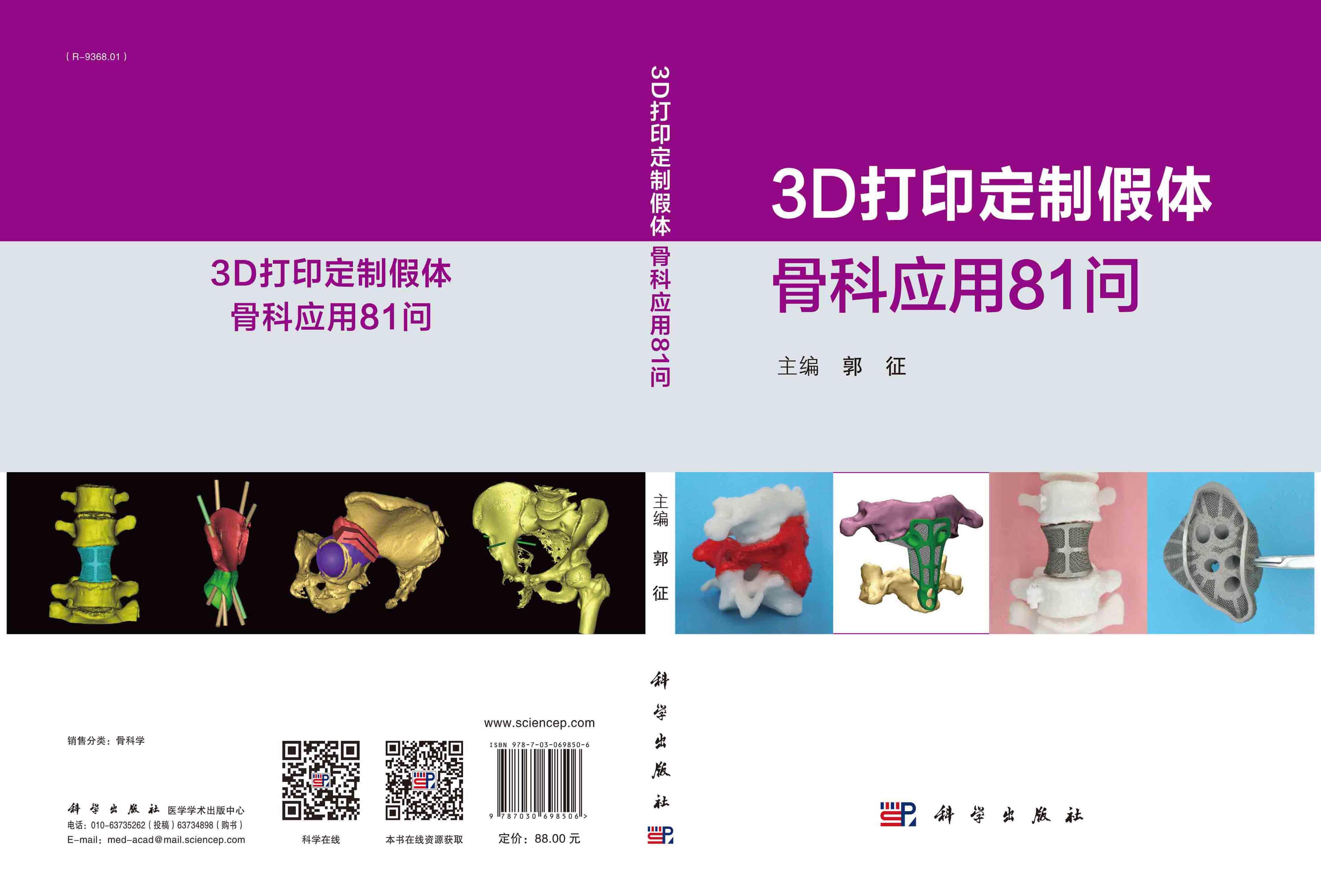 3D打印定制假体骨科应用81问