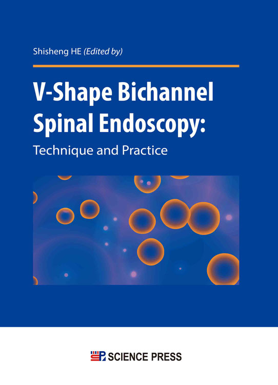 V形双通道脊柱内镜技术（英文版）